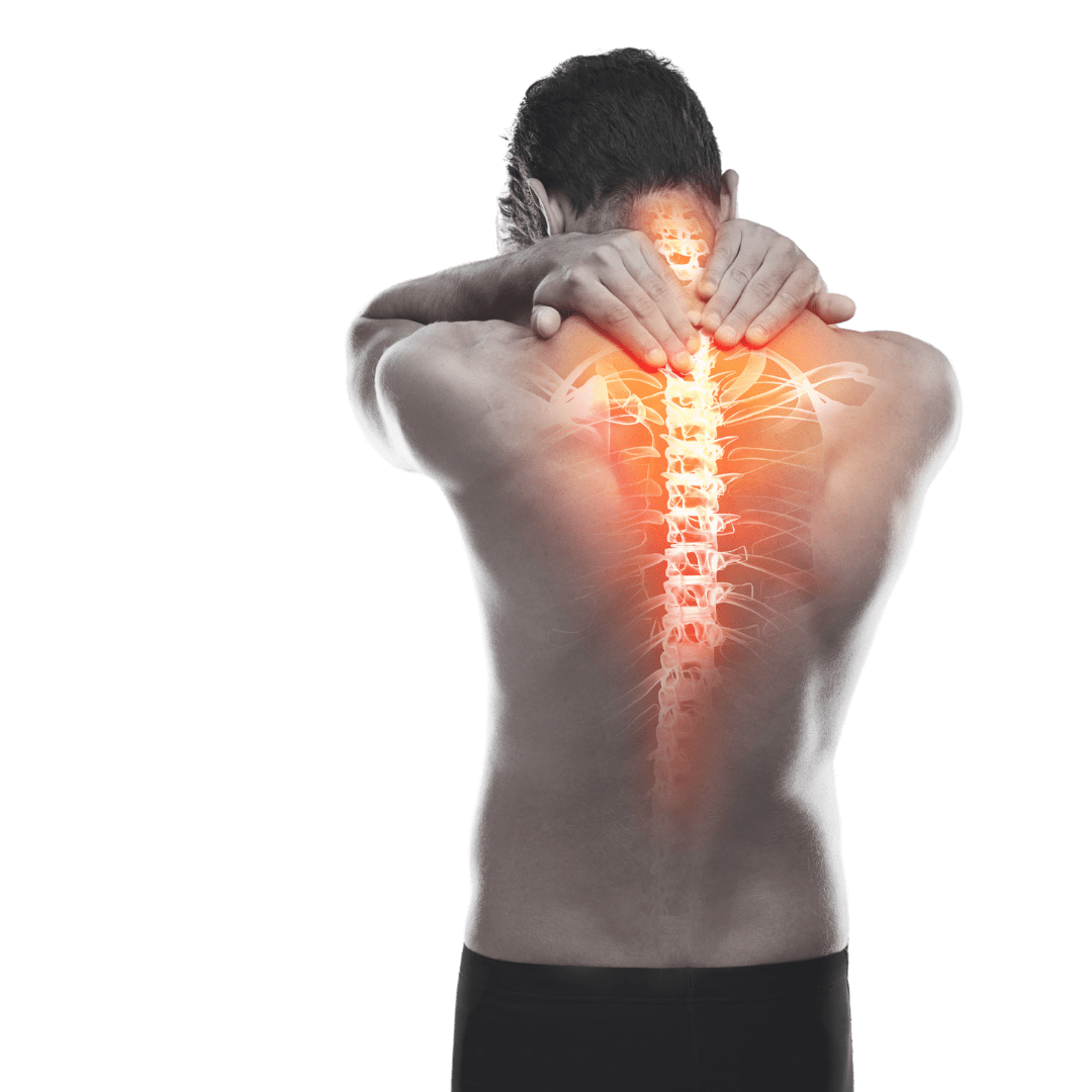 Scoliosis